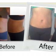 your-hcg-before-after_davelyn your-hcg-before-after_davelyn